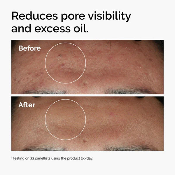 The Ordinary Niacinamide 10% + Zinc 1% Serum For Oily Skin 30ML