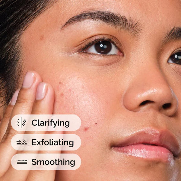 The Ordinary Salicylic Acid 2% Solution Exfoliating Serum For Acne 30ml
